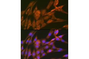 Immunofluorescence analysis of NIH-3T3 cells using 14-3-3 Theta Rabbit mAb (ABIN7265312) at dilution of 1:100 (40x lens). (14-3-3 theta Antikörper)