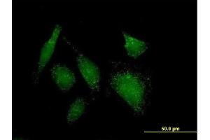 Immunofluorescence of purified MaxPab antibody to ACOT8 on HeLa cell. (ACOT8 Antikörper  (AA 1-319))