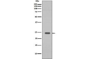 Western blot analysis of Rab9 expression in HepG2 cell lysate. (Rekombinanter RAB9A Antikörper)