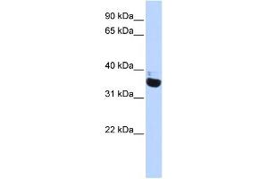 WB Suggested Anti-OR13C5 Antibody Titration:  0. (OR13C5 Antikörper  (N-Term))