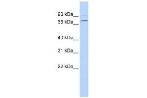 YTHDF3 antibody used at 1 ug/ml to detect target protein. (YTHDF3 Antikörper  (N-Term))