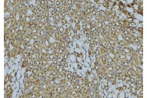 ABIN6273029 at 1/100 staining Mouse kidney tissue by IHC-P. (ACADS Antikörper)