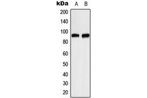 Western blot analysis of ITPKC expression in HeLa (A), RT4 (B) whole cell lysates. (ITPKC Antikörper  (Center))