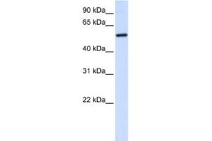 ALAS2 antibody used at 1 ug/ml to detect target protein.