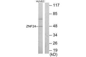 Western blot analysis of extracts from HUVEC cells, using ZNF24 antibody. (ZNF24 Antikörper  (N-Term))