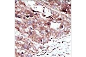 Immunohistochemistry (Paraffin-embedded Sections) (IHC (p)) image for anti-phosphorylase Kinase, gamma 2 (Testis) (PHKG2) (AA 41-71), (N-Term) antibody (ABIN391341)