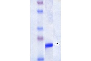 SDS-PAGE of native human 23 kDa p23 protein (ABIN1686720, ABIN1686721 and ABIN1686722).