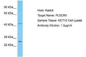 Host: Rabbit Target Name: PLSCR5 Sample Type: HCT15 Whole Cell lysates Antibody Dilution: 1. (PLSCR5 Antikörper  (C-Term))