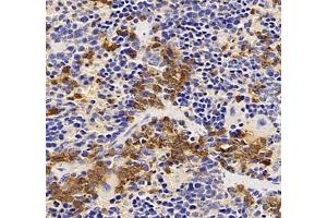 Immunohistochemistry of paraffin embedded mouse Immune spleen using CXCR1 (ABIN7073465) at dilution of 1: 2000 (400x lens) (CXCR1 Antikörper)