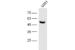 U251 lysates probed with IRF3 (Ser396) Polyclonal Antibody, unconjugated  at 1:300 overnight at 4°C followed by a conjugated secondary antibody at 1:10000 for 60 minutes at 37°C. (IRF3 Antikörper  (pSer396))