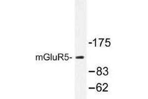 Image no. 1 for anti-Glutamate Receptor, Metabotropic 5 (GRM5) antibody (ABIN317705) (Metabotropic Glutamate Receptor 5 Antikörper)