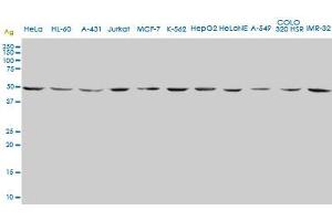 ENO2 monoclonal antibody (M01), clone 1A3. (ENO2/NSE Antikörper  (AA 325-434))