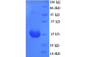 SDS-PAGE (SDS) image for Anti-Mullerian Hormone (AMH) (AA 450-552) protein (His tag) (ABIN5713220)