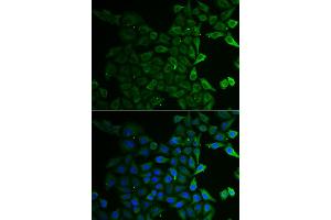Immunofluorescence analysis of HeLa cells using C21orf33 antibody. (C21orf33 Antikörper)