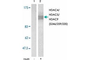 Western blot analysis of extracts from NIH/3T3 cell using HDAC4/HDAC5/HDAC9 (phospho S246/259/220) polyclonal antibody . (HDAC4 Antikörper  (pSer220, pSer246, pSer259))