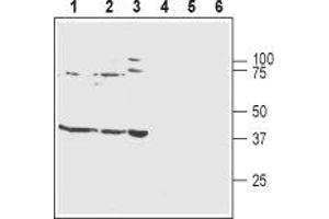 Western blot analysis of rat brain membranes (lanes 1 and 4), mouse brain membranes (lanes 2 and 5) and human SH-SY5Y neuroblastoma cell lysates (lanes 3 and 6): - 1-3. (KCNJ10 Antikörper  (Intracellular))
