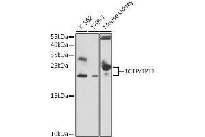 Western blot analysis of extracts of various cell lines, using TCTP/TCTP/TPT1 antibody  at 1:1000 dilution. (TPT1 Antikörper  (AA 1-172))
