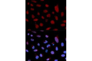 Immunofluorescence (IF) image for anti-Cardiac Troponin C (TNNC1) (AA 1-160) antibody (ABIN6219070) (TNNC1 Antikörper  (AA 1-160))