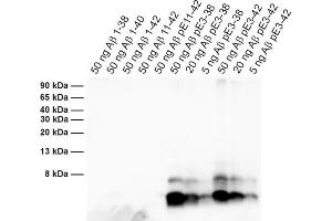 Detection of different synthetic Abeta species (dilution 1 : 1000). (Abeta-pE3 Antikörper)