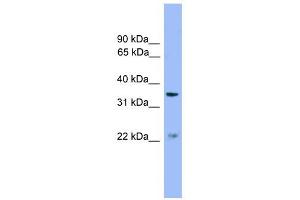ZDHHC21 antibody used at 1 ug/ml to detect target protein.