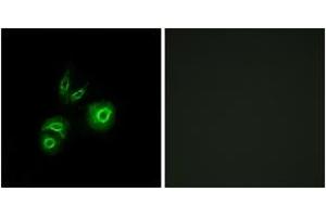 Immunofluorescence analysis of A549 cells, using MET Antibody. (c-MET Antikörper  (AA 276-325))