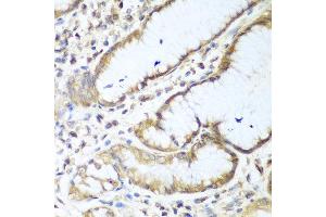 Immunohistochemistry of paraffin-embedded human stomach using NUDT15 antibody at dilution of 1:100 (40x lens). (NUDT15 Antikörper)