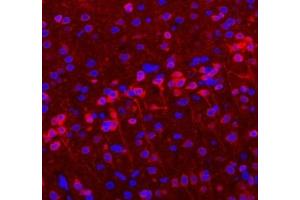 Immunofluorescent analysis of paraformaldehyde-fixed rat brain using VMAT2 (ABIN7075655) at dilution of 1: 1600 (SLC18A2 Antikörper)