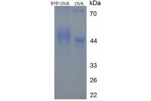 Image no. 2 for Synaptophysin (SYP) (AA 255-290) peptide (Ovalbumin) (ABIN5666379)