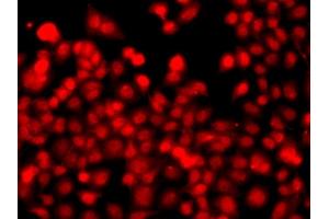 Immunofluorescence analysis of  cells using TH antibody (ABIN6128823, ABIN6149105, ABIN6149106 and ABIN6223361). (THAP1 Antikörper  (AA 1-213))