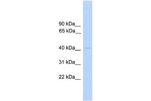 WB Suggested Anti-PRKAR1A Antibody Titration: 0. (PRKAR1A Antikörper  (C-Term))
