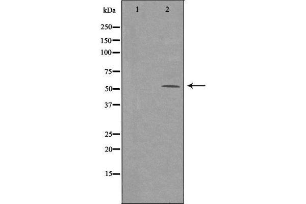 ARMC6 Antikörper  (C-Term)