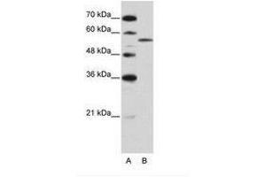 Image no. 2 for anti-Zinc Finger (CCCH Type), RNA-Binding Motif and serine/arginine Rich 2 (ZRSR2) (AA 369-418) antibody (ABIN202635) (ZRSR2 Antikörper  (AA 369-418))