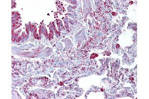 Anti-GABRB3 antibody IHC of human lung.