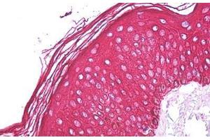 Anti-Cytokeratin 1 / Keratin 1 antibody IHC staining of human skin. (Cytokeratin 1 Antikörper  (Internal Region))