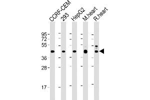 All lanes : Anti-VEGFC at 1:2000 dilution Lane 1: CCRF-CEM whole cell lysate Lane 2: 293 whole cell lysate Lane 3: HepG2 whole cell lysate Lane 4: mouse heart lysate Lane 5: rat heart lysate Lysates/proteins at 20 μg per lane. (VEGFC Antikörper)