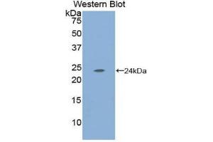 Western Blotting (WB) image for anti-Carbonic Anhydrase I (CA1) (AA 15-223) antibody (ABIN1173857) (CA1 Antikörper  (AA 15-223))