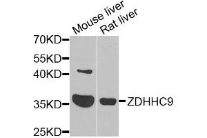 Western blot analysis of extracts of various cells, using ZDHHC9 antibody. (ZDHHC9 Antikörper)