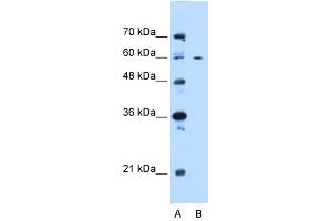 WB Suggested Anti-CEP55 Antibody Titration:  0. (CEP55 Antikörper  (N-Term))