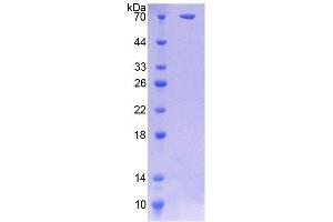 SDS-PAGE analysis of Human SGSH Protein. (SGSH Protein)