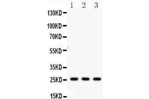 Anti- SFTP A1/2 Picoband antibody, Western blotting All lanes: Anti SFTP  at 0. (SFTPA1/ 2 (AA 206-237), (C-Term) Antikörper)