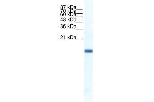 WB Suggested Anti-FERD3L Antibody   Titration: 1. (FERD3L Antikörper  (N-Term))
