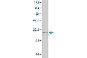 Western Blot detection against Immunogen (37. (FOXL1 Antikörper  (AA 132-240))