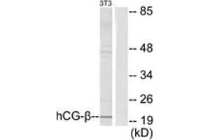 Western blot analysis of extracts from NIH-3T3 cells, using hCG beta Antibody. (HCG beta Antikörper  (AA 101-150))
