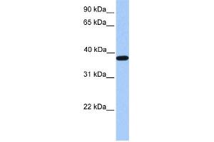 WB Suggested Anti-ACTRT2 Antibody Titration: 0. (ACTRT2 Antikörper  (C-Term))