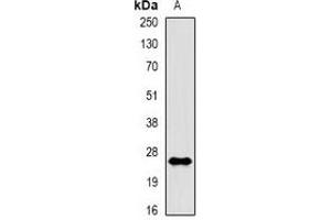 Western blot analysis of Rac 1 (pS71) expression in A431 EGF-treated (A) whole cell lysates. (RAC1 Antikörper  (pSer71))