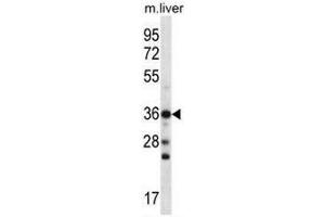 CBX8 Antibody (Center) western blot analysis in mouse liver tissue lysates (35µg/lane).