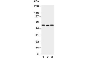 Western blot testing of XIAP antibody and Lane 1:  SMMC-7721;  2: HeLa;  3: A431 cell lysate