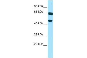 WB Suggested Anti-HABP4 Antibody Titration: 1. (HABP4 Antikörper  (N-Term))