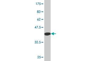 Western Blot detection against Immunogen (36. (EPOR Antikörper  (AA 31-130))