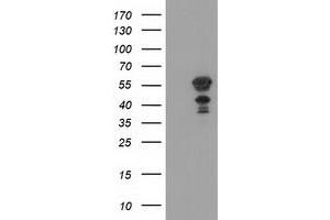 Western Blotting (WB) image for anti-Katanin P60 Subunit A-Like 1 (KATNAL1) antibody (ABIN1498985) (KATNAL1 Antikörper)